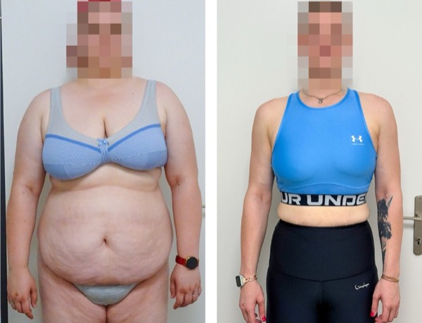 Transformation B.C.